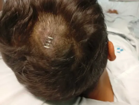 Heridas sufridas por el atropellado 2