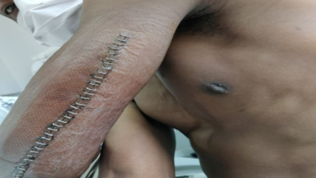 Violencia racial en Bilbao