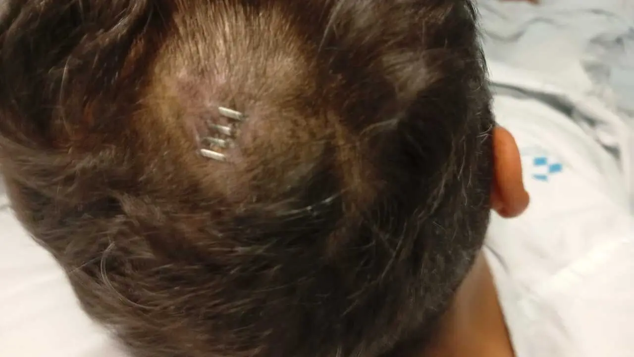 Heridas sufridas por el atropellado 2