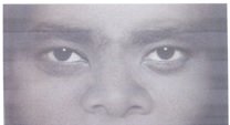 Rostro canario