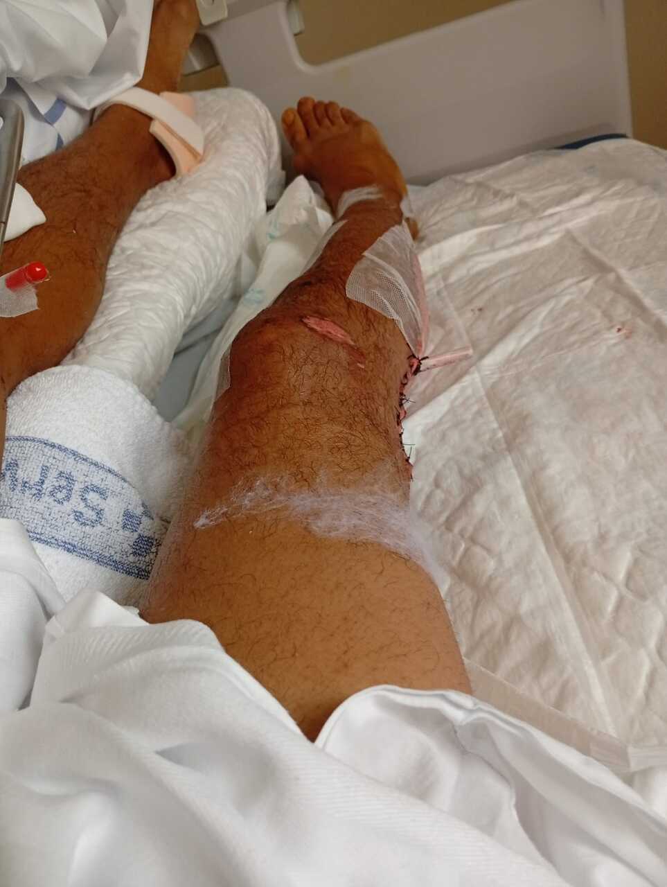 Heridas sufridas por el atropellado 3